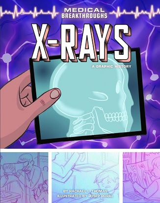 Medical Breakthroughs: X-Rays A Graphic History